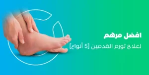 افضل مرهم لعلاج الشوكة العظمية