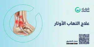 أفضل مضاد حيوي لعلاج التهاب الأوتار