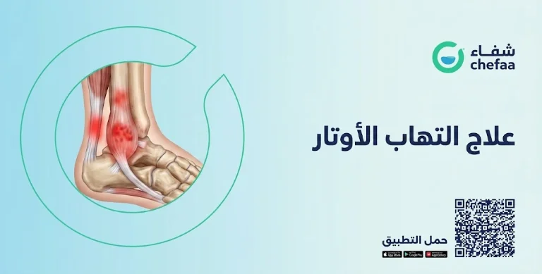 أفضل مضاد حيوي لعلاج التهاب الأوتار